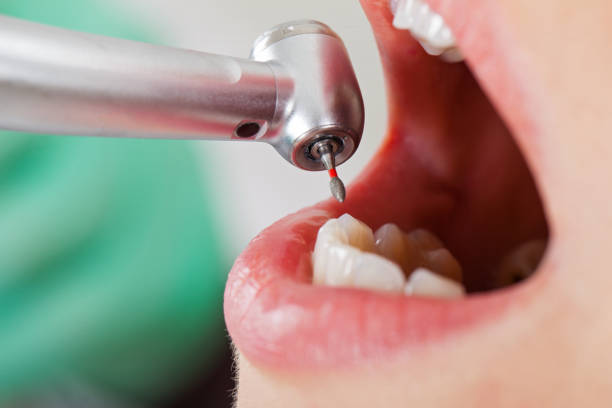 Best Emergency Treatment for Oral Infections in Goldendale, WA
